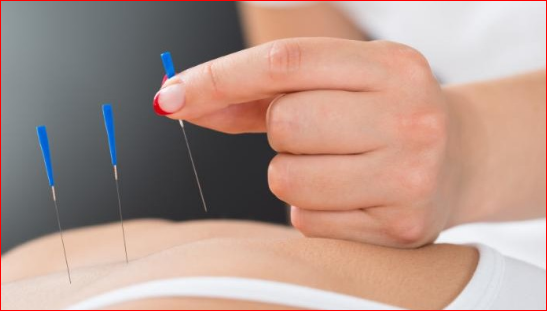 Acupuncture Clinic Pickering