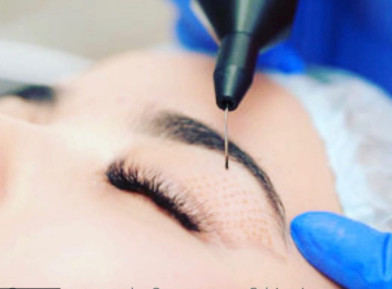 Non surgical eye lift Sydney